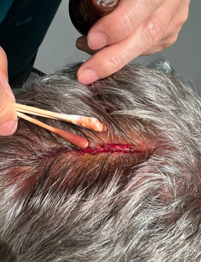 在赛后新无, 在更换, 厘米 在赛后新无, 在更换, 厘米